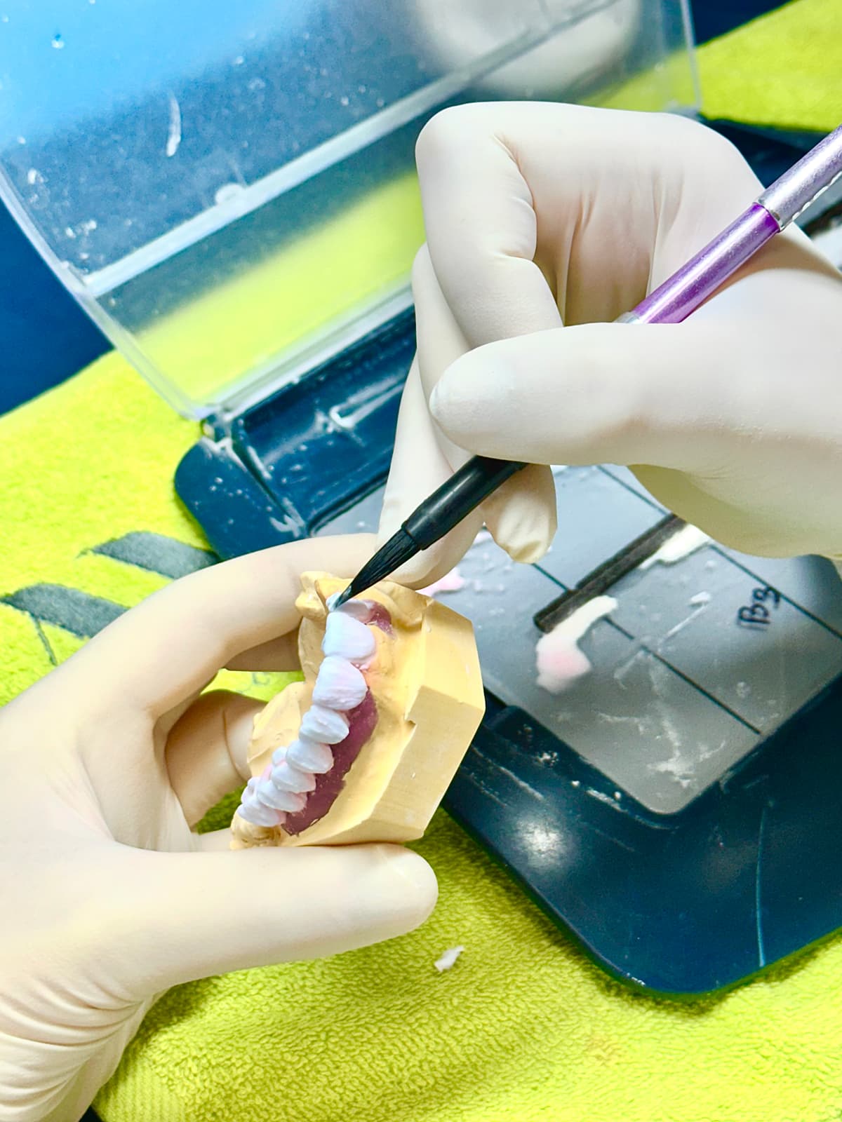 Dental Paz - Diseño, fabricación y adaptación de prótesis dentales